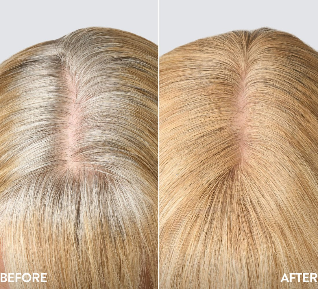 Roots before and after, in Blonde