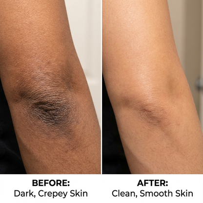Before and after - elbow