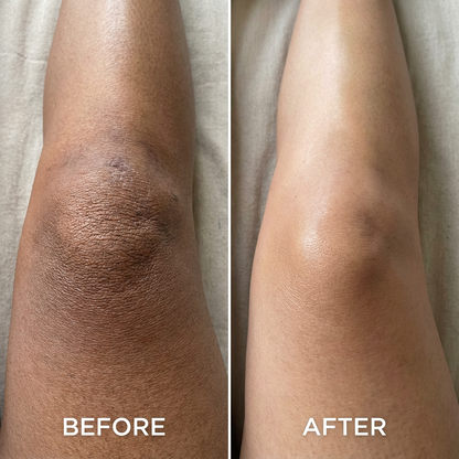 Before and after - knee