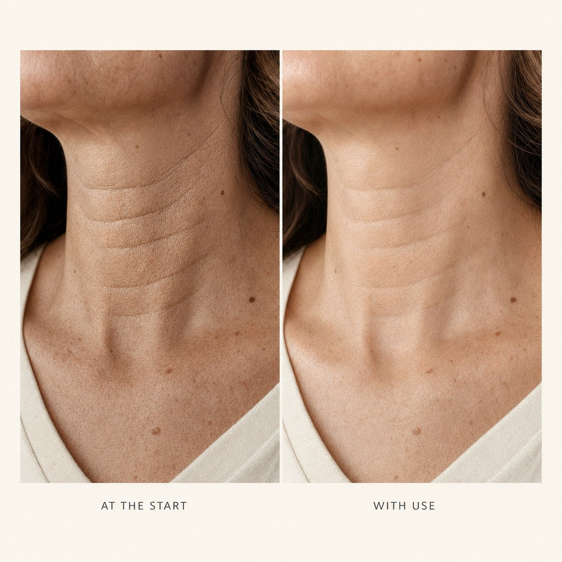 Close-up of a neck showing horizontal lines at the start and with use