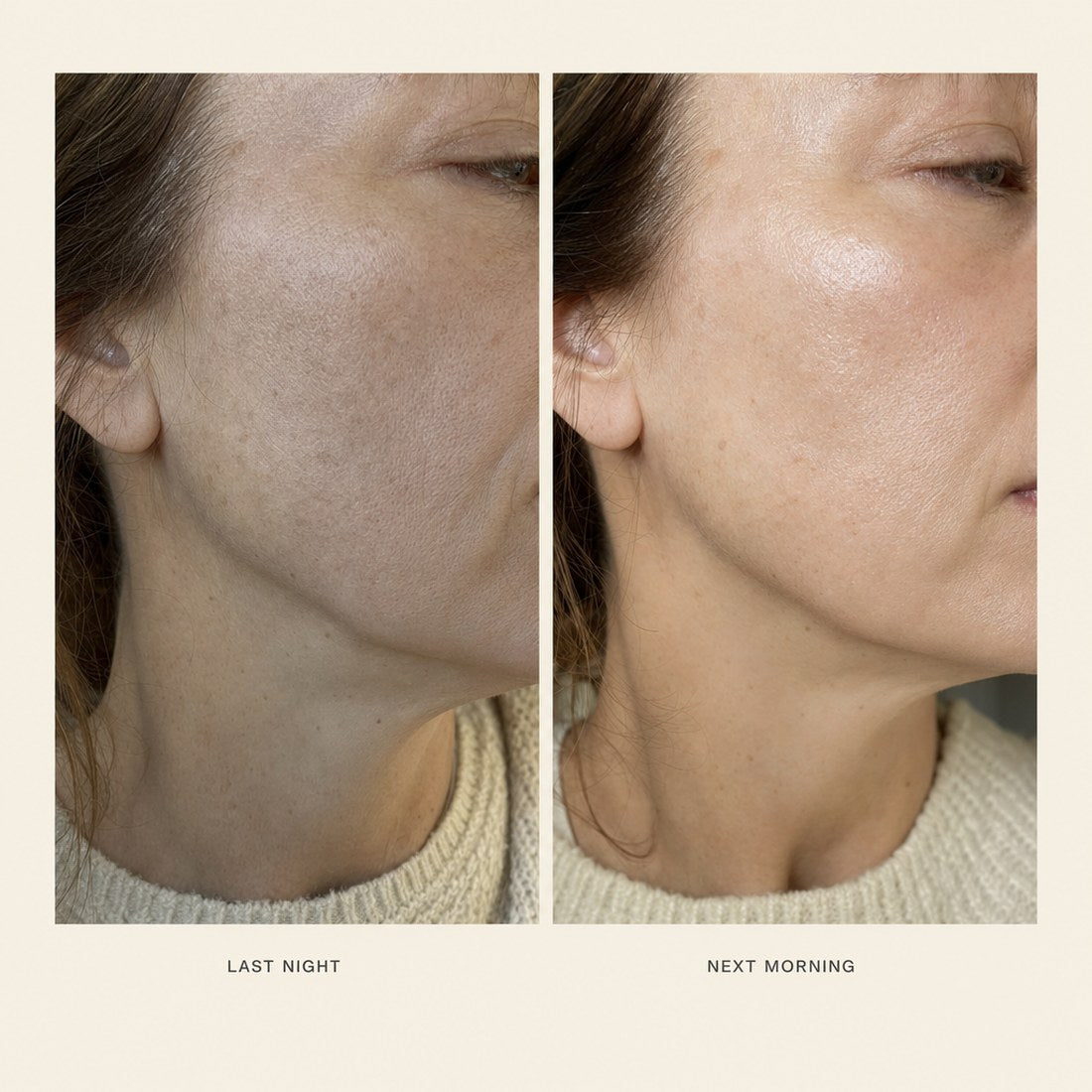 The same cheek photographed at night and the next morning, showing fuller-looking skin