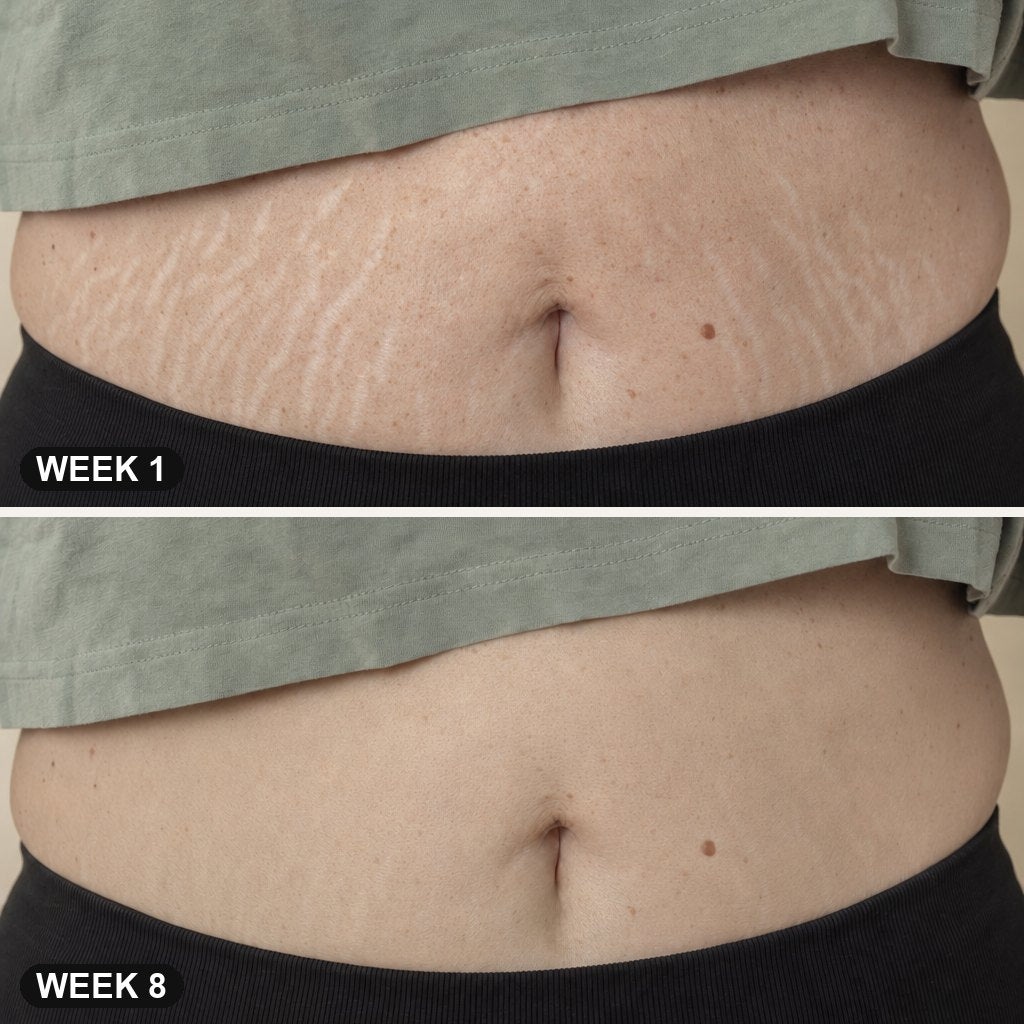 Customer photo, week one beside week eight