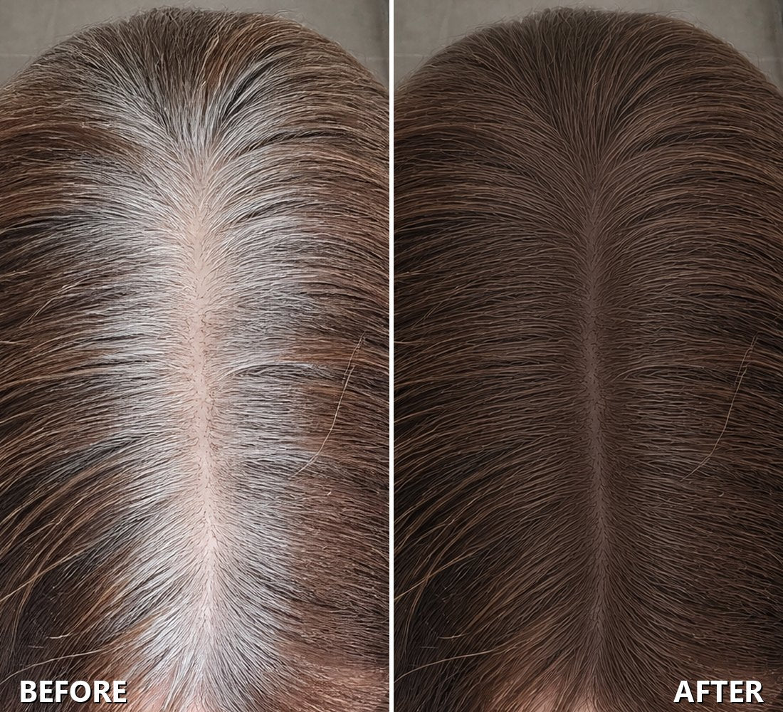 Roots before and after, in Medium Brown
