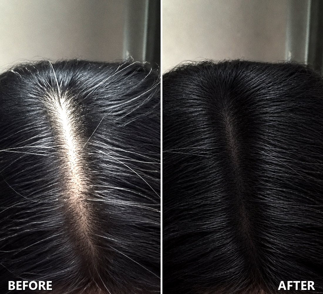 Roots before and after, in Black