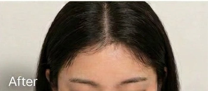 After