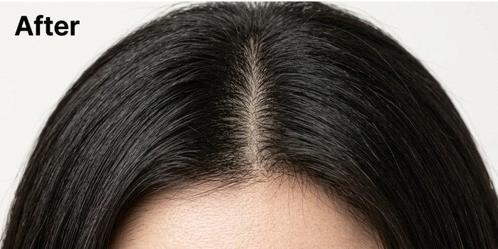 After