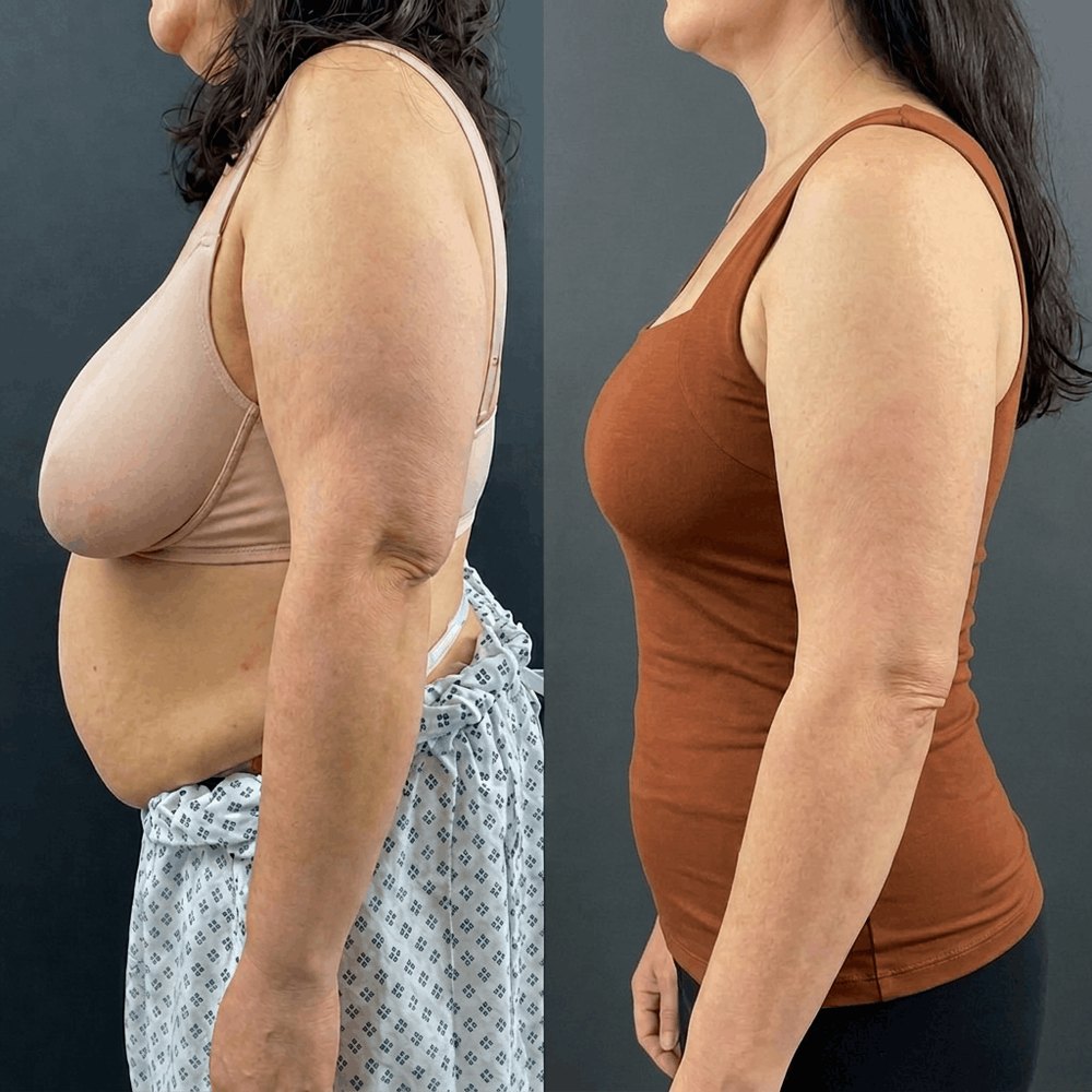 Before and after wearing the tank